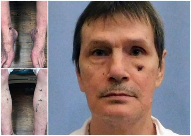 快弄死我！美国死囚挨12针也死不了 扎到尿血