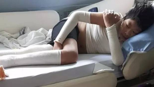 加拿大华人男孩患“噬肉病” 身体正被细菌吃掉