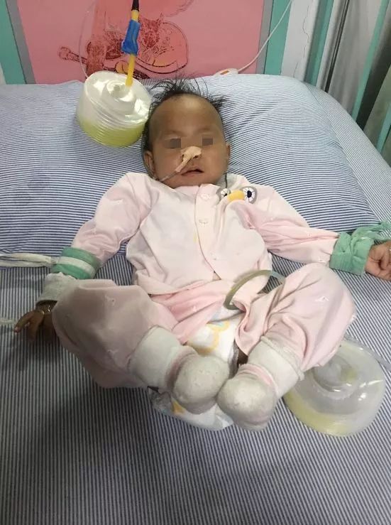 1岁女婴胃被撑破 竟是因妈妈喂了她这种常见食物