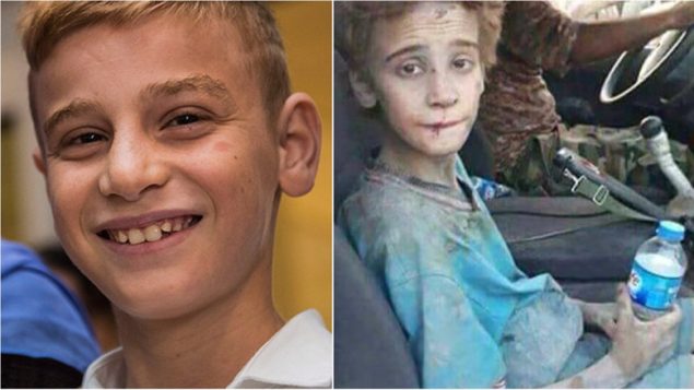 温尼伯的亚兹迪难民男童希望见总理特鲁多