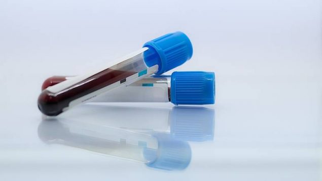 少半数加拿大人需要做丙肝检测