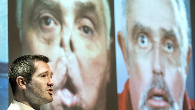 加拿大第一例换脸手术：优秀医生和彪悍患者