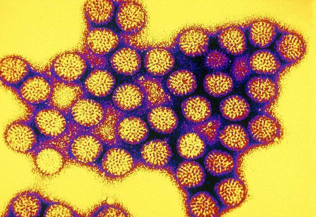科学家发现一种可以注射的病毒 能有效抗癌