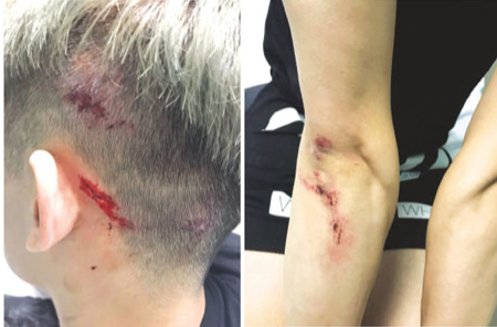 近日大温路火事件不断，这次受害者是华裔