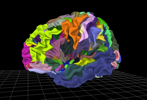 多层次人脑“活”图谱成新型诊断工具，可帮助研究精神疾病