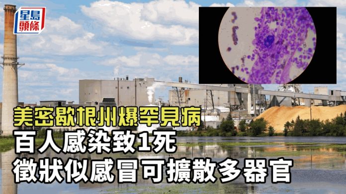 致命病症超似感冒！美发病破百例1死 “真凶”侵袭多部位