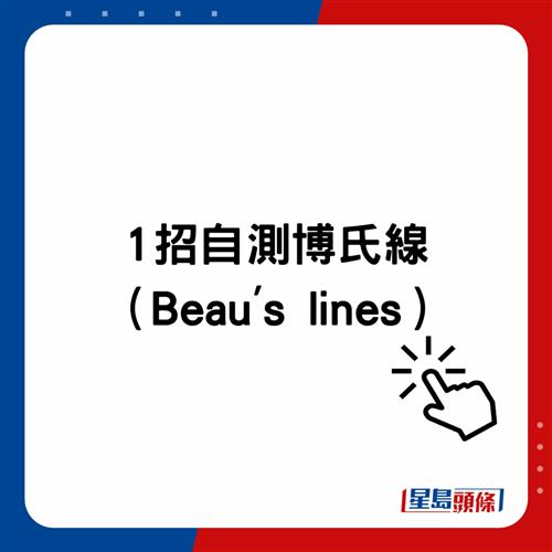 20221203_health_nail1_1