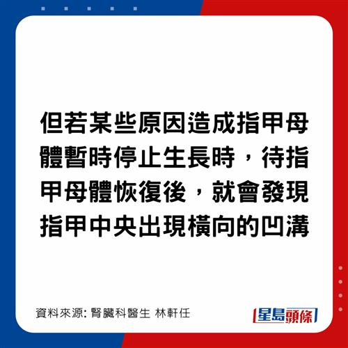 20221203_health_nail1_6