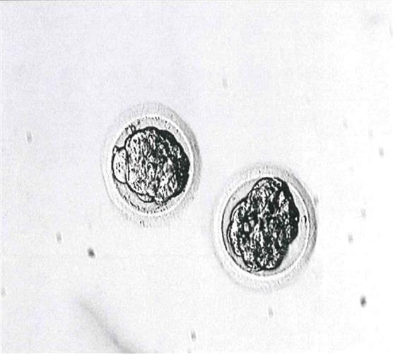 英美科学家成功利用干细胞创造出合成人类胚胎。