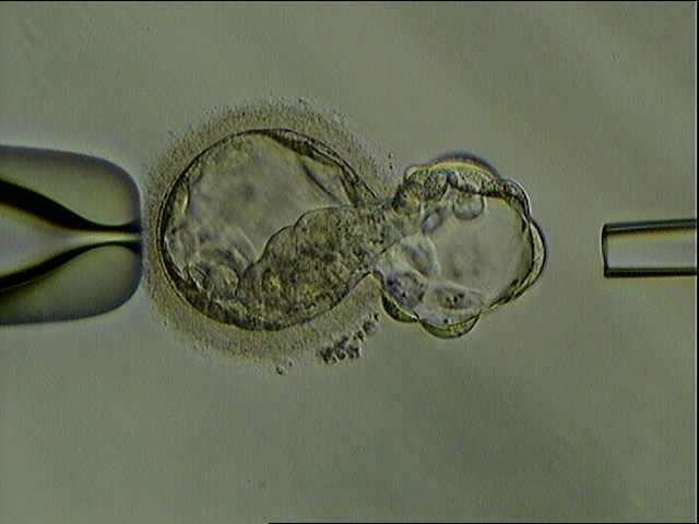 英美科学家成功利用干细胞创造出合成人类胚胎。
